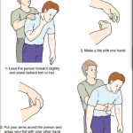 How to do the Heimlich Maneuver